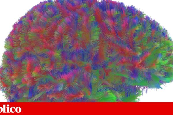 Há cinco fases do cérebro ao longo da vida, com alterações aos nove, 32, 66 e 83 anos