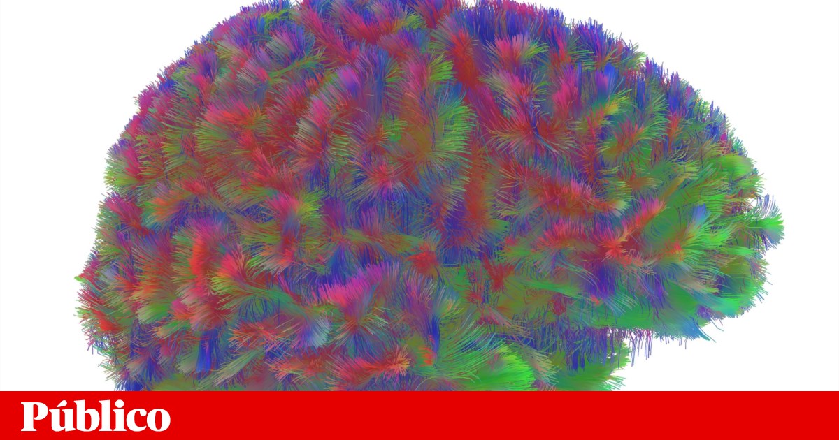 Há cinco fases do cérebro ao longo da vida, com alterações aos nove, 32, 66 e 83 anos