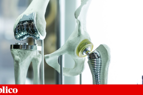 ISQ lidera projecto de implantes criados com IA e impressão 3D