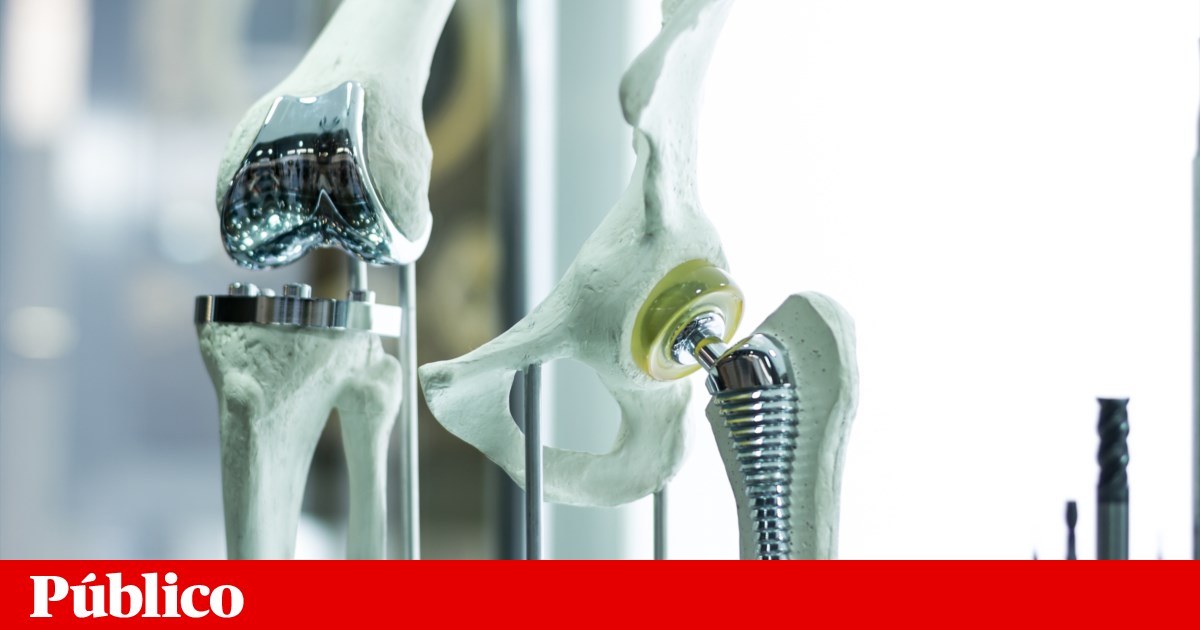ISQ lidera projecto de implantes criados com IA e impressão 3D