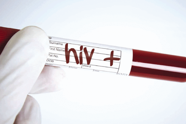 Por que a nutrição deve estar no centro da resposta ao HIV?