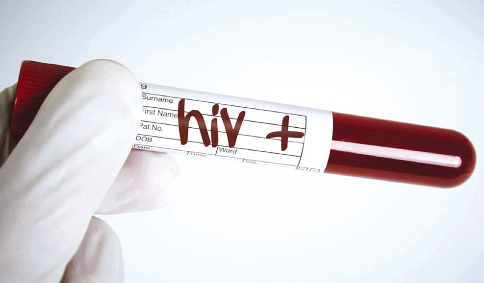 Por que a nutrição deve estar no centro da resposta ao HIV?