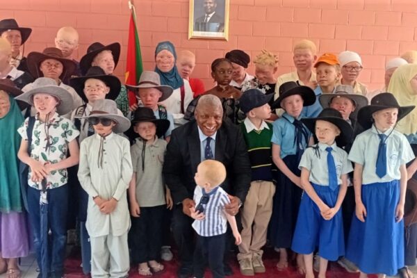 Alunos com albinismo recebem apoio em Cabo Delgado